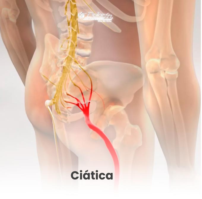 Tratamientos de quiropráctica en Monterrey para dolor muscular y articular.